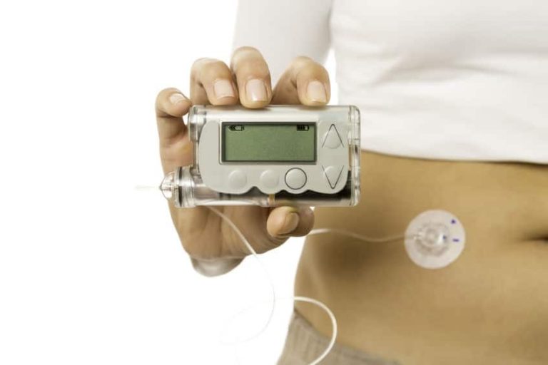 Insulin Pump vs Injections