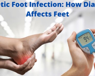 Diabetic Foot Infection: How Diabetes Affects Feet
