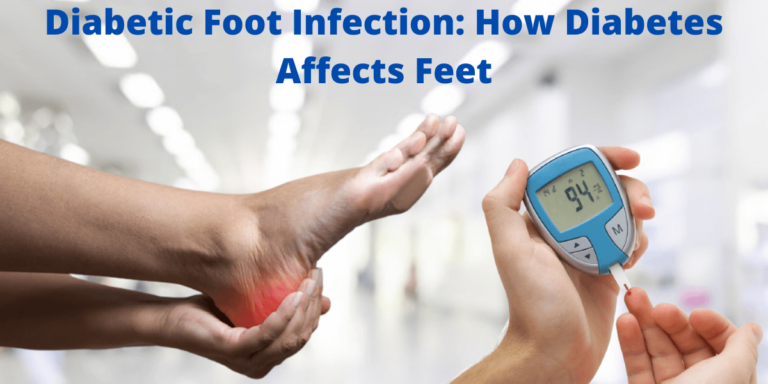 Diabetic Foot Infection: How Diabetes Affects Feet