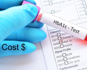 A1C Test Cost – Average Pricing, Locations and Options