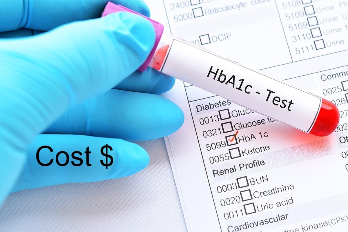 A1C Test Cost – Average Pricing, Locations and Options